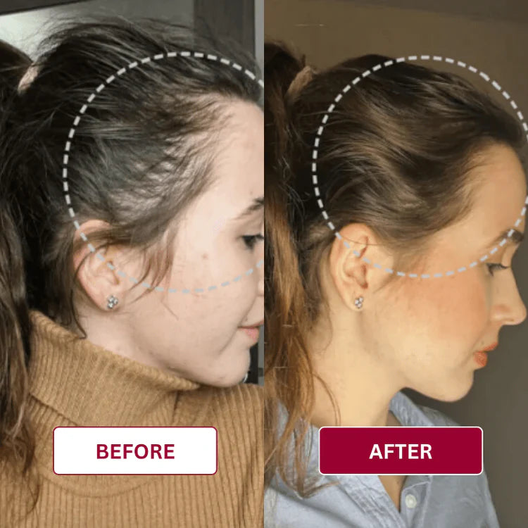 Vitalitie Hair Hochfrequenzstab